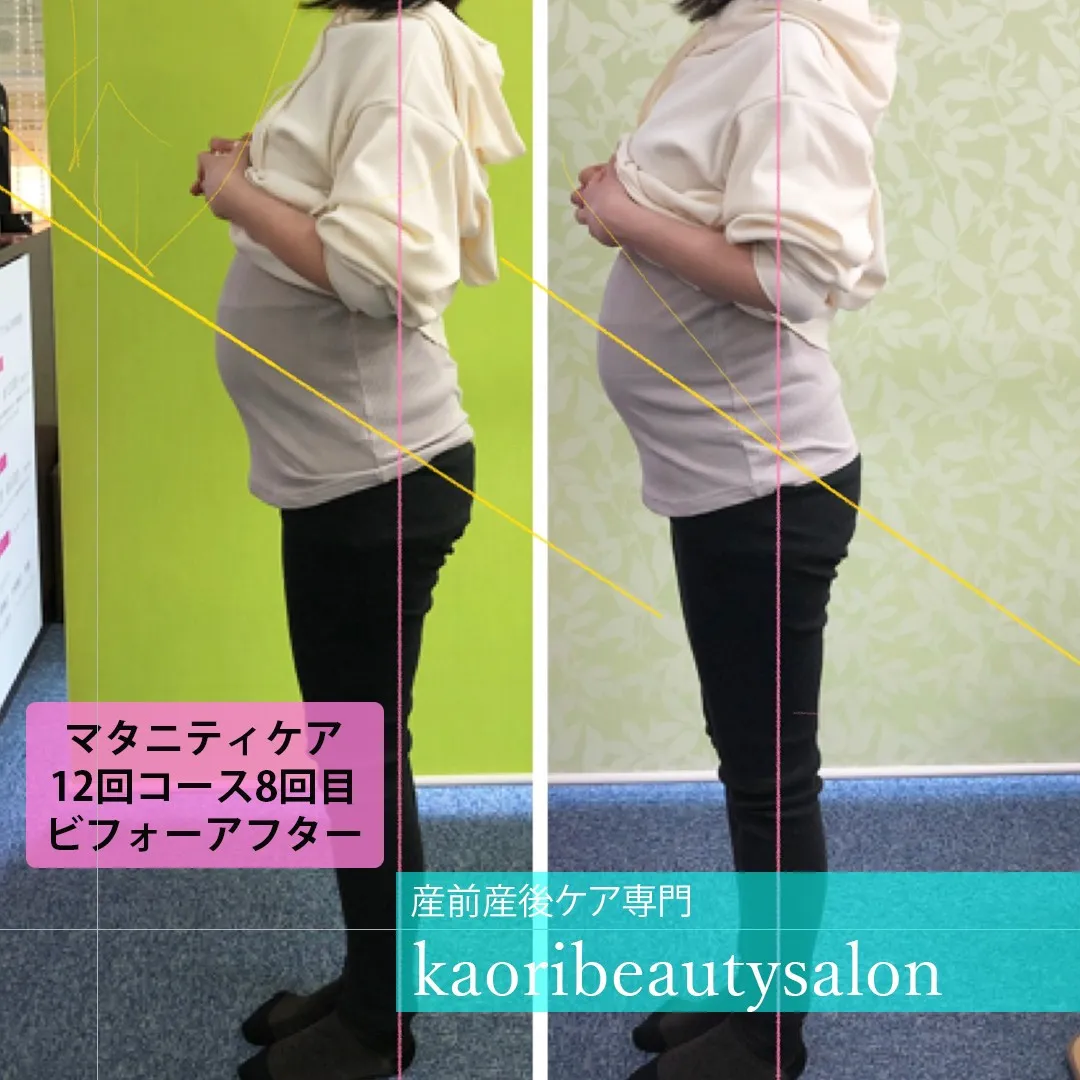 【マタニティケアコースの12回目のうちの8回目の左側面ビフォ...
